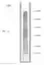 Fig. 13 - Sorbent devices with longitudinal diffusion paths and methods of using them