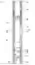 Fig. 01 - Well tool with combined actuation of multiple valves