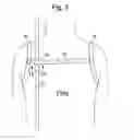 Fig. 03 - HANDS-FREE UMBRELLA HARNESS
