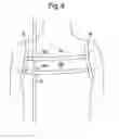 Fig. 06 - HANDS-FREE UMBRELLA HARNESS