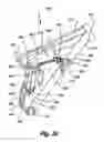Fig. 20 - Rear suspension system for a bicycle