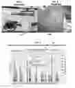 Fig. 02 - Flexible head of bed elevation device and alarm