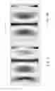 Fig. 06 - Mixing frequency at multiple feeding points