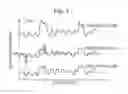 Fig. 09 - METHOD OF CORRECTING PIXEL DATA AND FLUID EJECTING APPARATUS