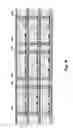 Fig. 09 - Electronic package with stacked modules with channels passing through metal layers of the modules