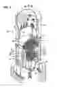 Fig. 03 - System for assembling or disassembling a segmented rod