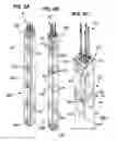 Fig. 09 - System for assembling or disassembling a segmented rod