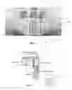 Fig. 02 - Extra-oral digital panoramic dental X-ray imaging system