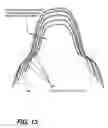 Fig. 12 - Extra-oral digital panoramic dental X-ray imaging system