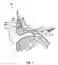 Fig. 02 - Signal processing for cochlear implants