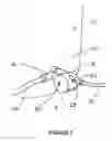 Fig. 03 - IRRIGATION AID