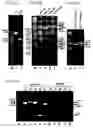 Fig. 03 - Recombinant virus vector originating in HHV-6 or HHV-7, method of producing the same, method of transforming host cell using the same, host cell transformed thereby and gene therapy method using the same