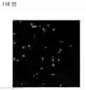 Fig. 20 - Recombinant virus vector originating in HHV-6 or HHV-7, method of producing the same, method of transforming host cell using the same, host cell transformed thereby and gene therapy method using the same