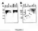 Fig. 03 - Goodpasture Antigen Binding Protein