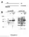 Fig. 04 - Goodpasture Antigen Binding Protein