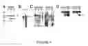 Fig. 05 - Goodpasture Antigen Binding Protein