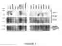 Fig. 10 - Goodpasture Antigen Binding Protein