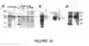 Fig. 11 - Goodpasture Antigen Binding Protein