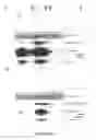 Fig. 12 - Goodpasture Antigen Binding Protein