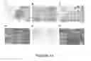 Fig. 15 - Goodpasture Antigen Binding Protein