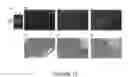 Fig. 16 - Goodpasture Antigen Binding Protein