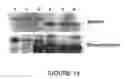 Fig. 19 - Goodpasture Antigen Binding Protein
