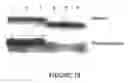 Fig. 20 - Goodpasture Antigen Binding Protein