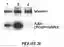 Fig. 21 - Goodpasture Antigen Binding Protein
