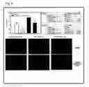 Fig. 06 - Telomerase reverse transcriptase variant