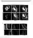 Fig. 02 - Biologic Modulations with Nanoparticles