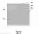 Fig. 05 - Methods and apparatus for rapid imprint lithography