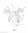 Fig. 02 - DEVICE, SYSTEM AND METHOD FOR DENTAL TREATMENT