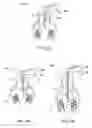 Fig. 07 - DEVICE, SYSTEM AND METHOD FOR DENTAL TREATMENT