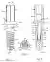 Fig. 02 - Arrangement for insertion of implants