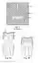 Fig. 02 - Method of making a facing for a dental restoration, facing for a dental restoration, and method of making a dental restoration
