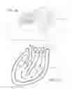 Fig. 04 - Inflatable exhibit of a human heart and method