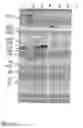 Fig. 03 - Methods for determining the presence or absence of elite event RF-BN1 in plant material
