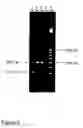 Fig. 06 - Methods for determining the presence or absence of elite event RF-BN1 in plant material