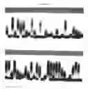 Fig. 04 - METHODS AND MATERIALS FOR DETECTING FRAGILE X MUTATIONS