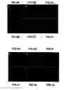 Fig. 06 - Gene and protein relating to hepatocellular carcinoma and methods of use thereof