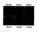 Fig. 07 - Gene and protein relating to hepatocellular carcinoma and methods of use thereof