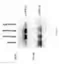 Fig. 06 - Methods for Assessing Cancer for Increased Sensitivity to 10-Propargyl-10-Deazaaminopterin by Assessing Egfr Levels