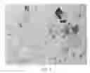 Fig. 10 - Method for isolation of inner cell mass and method of preparation of embryonic stem cell lines using inner cell mass isolated by the same