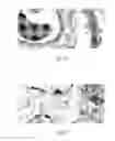 Fig. 07 - N-acetyl mannosamine as a therapeutic agent