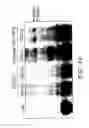 Fig. 53 - NELL peptide expression systems and bone formation activity of NELL peptide