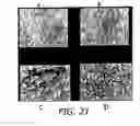 Fig. 55 - NELL peptide expression systems and bone formation activity of NELL peptide