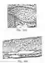 Fig. 63 - NELL peptide expression systems and bone formation activity of NELL peptide