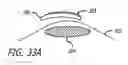 Fig. 65 - NELL peptide expression systems and bone formation activity of NELL peptide