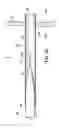 Fig. 06 - TWO-PIECE TRANSSEPTAL CANNULA, DELIVERY SYSTEM, AND METHOD OF DELIVERY