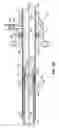 Fig. 11 - TWO-PIECE TRANSSEPTAL CANNULA, DELIVERY SYSTEM, AND METHOD OF DELIVERY